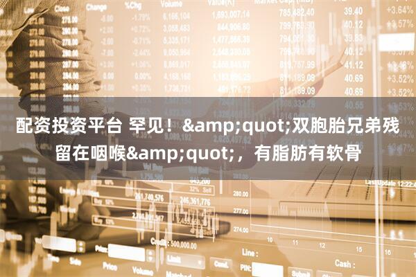 配资投资平台 罕见！"双胞胎兄弟残留在咽喉"，有脂肪有软骨